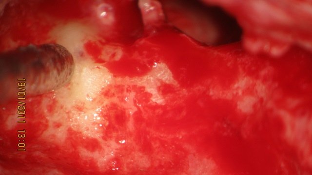 Dr Kumaresh ENT Clinic - Dr Kumaresh ENT Clinic