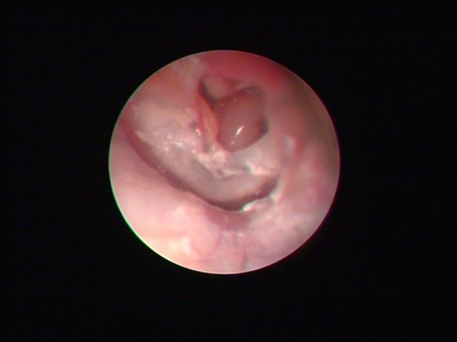 Dr Kumaresh ENT Clinic - Dr Kumaresh ENT Clinic