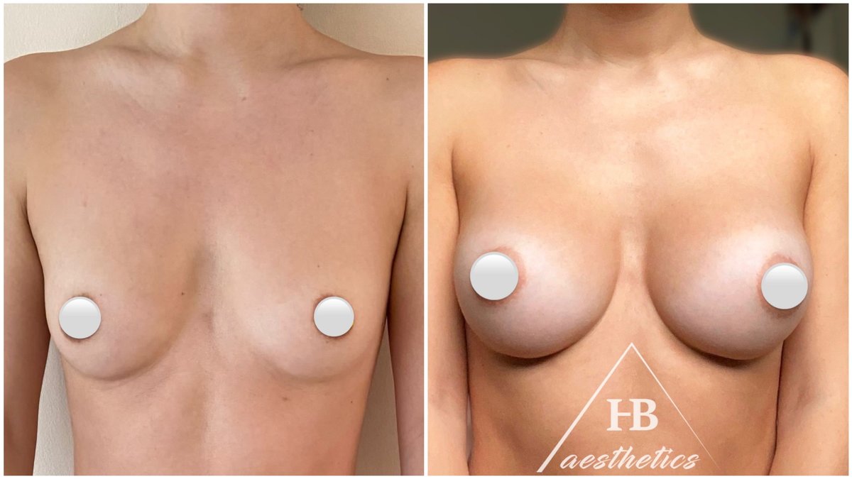 DR. M. HAKAN BULAM AESTHETIC PLASTIC SURGERY - DR. M. HAKAN BULAM AESTHETIC PLASTIC SURGERY