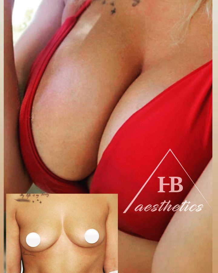 DR. M. HAKAN BULAM AESTHETIC PLASTIC SURGERY - DR. M. HAKAN BULAM AESTHETIC PLASTIC SURGERY