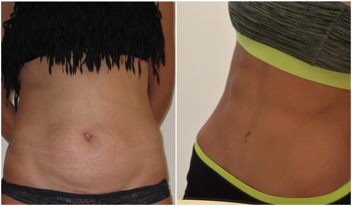 DR. M. HAKAN BULAM AESTHETIC PLASTIC SURGERY - DR. M. HAKAN BULAM AESTHETIC PLASTIC SURGERY