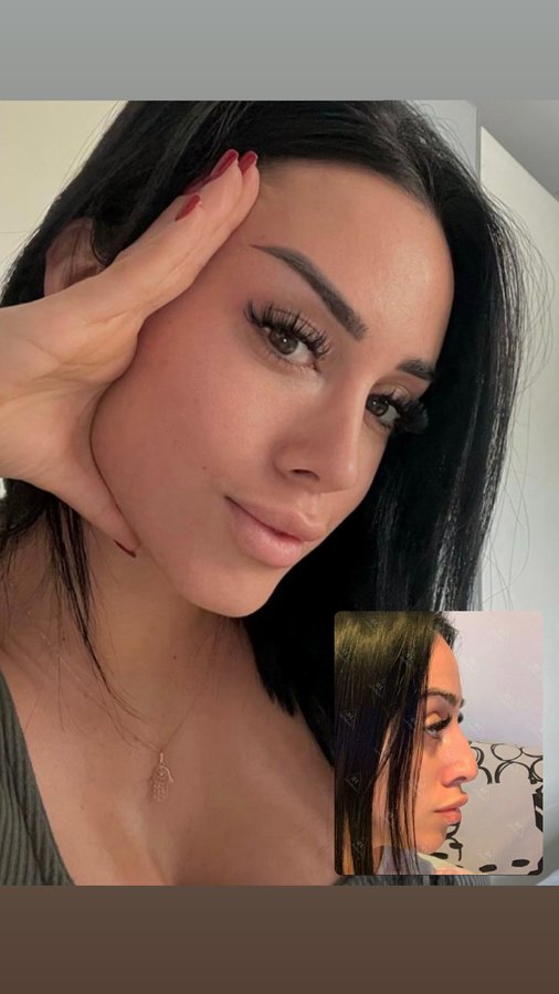 DR. M. HAKAN BULAM AESTHETIC PLASTIC SURGERY - DR. M. HAKAN BULAM AESTHETIC PLASTIC SURGERY