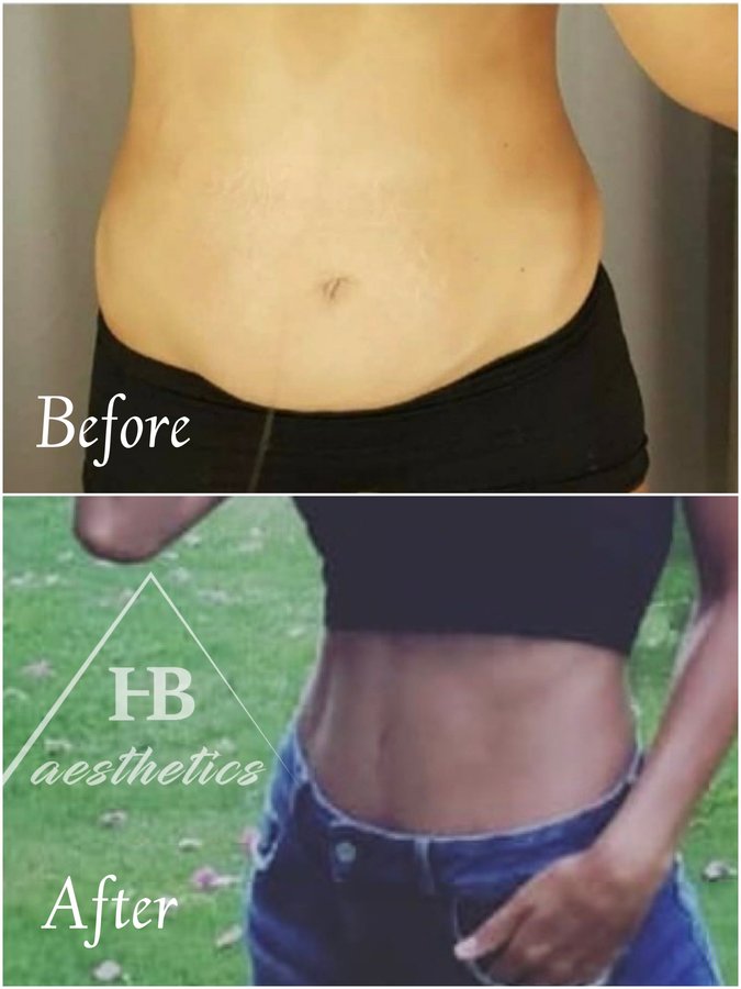 DR. M. HAKAN BULAM AESTHETIC PLASTIC SURGERY - DR. M. HAKAN BULAM AESTHETIC PLASTIC SURGERY