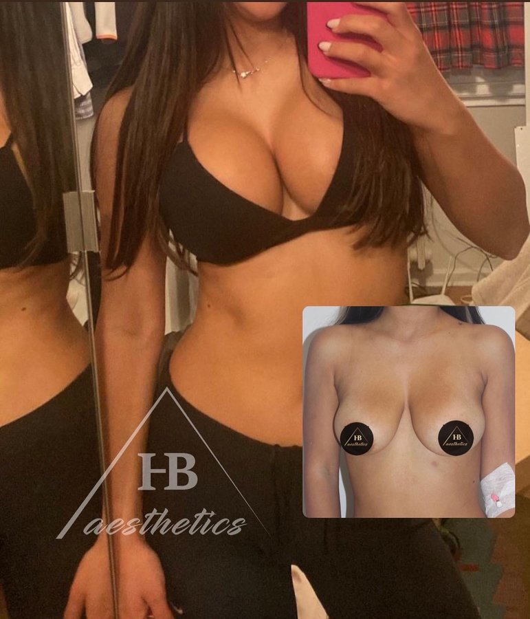 DR. M. HAKAN BULAM AESTHETIC PLASTIC SURGERY - DR. M. HAKAN BULAM AESTHETIC PLASTIC SURGERY