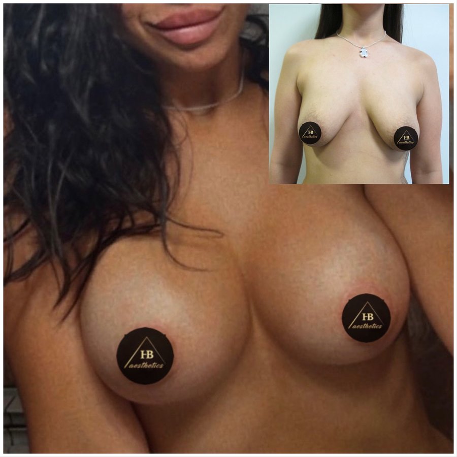 DR. M. HAKAN BULAM AESTHETIC PLASTIC SURGERY - DR. M. HAKAN BULAM AESTHETIC PLASTIC SURGERY