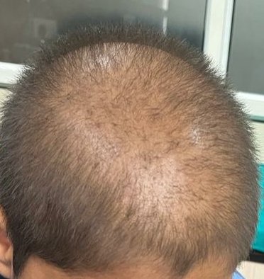 Dr Madhusoodan Gupta - Dr Madhusoodan Gupta