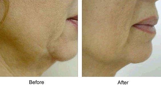 Dr. Manlio Speziale - Dr. Manlio Speziale