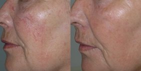 Dr. Manlio Speziale - Dr. Manlio Speziale