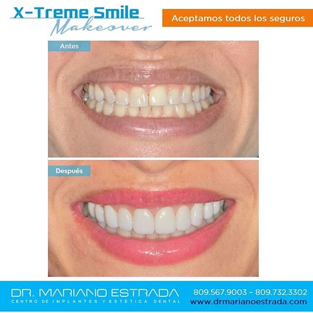 Dr Mariano Estrada CENTRO IMPLANTES Y ESTETICA - Dr Mariano Estrada CENTRO IMPLANTES Y ESTETICA