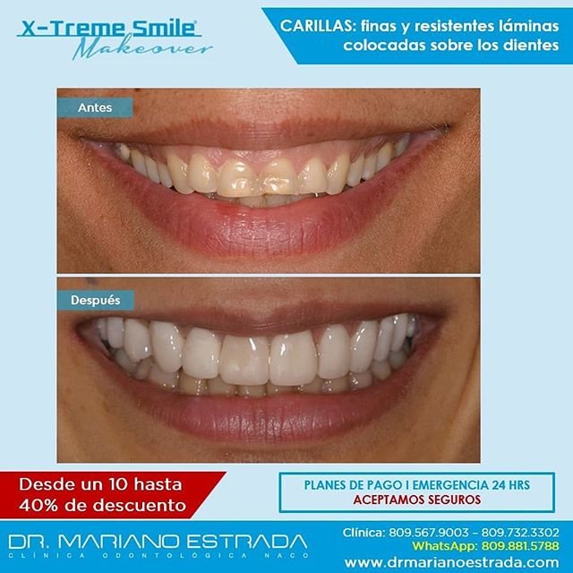 Dr Mariano Estrada CENTRO IMPLANTES Y ESTETICA - Dr Mariano Estrada CENTRO IMPLANTES Y ESTETICA