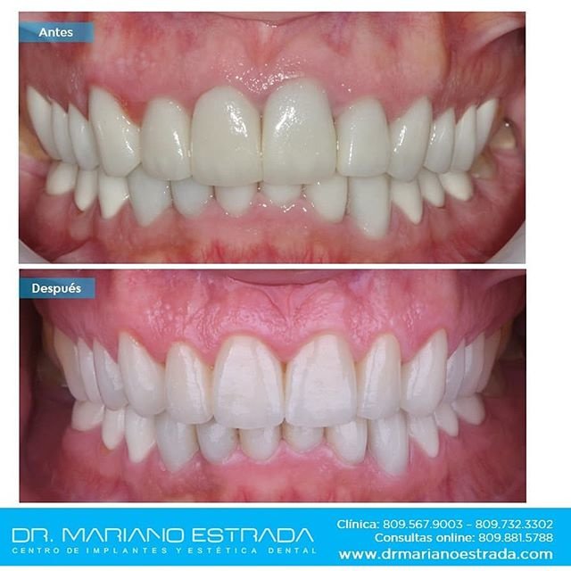 Dr Mariano Estrada CENTRO IMPLANTES Y ESTETICA - Dr Mariano Estrada CENTRO IMPLANTES Y ESTETICA