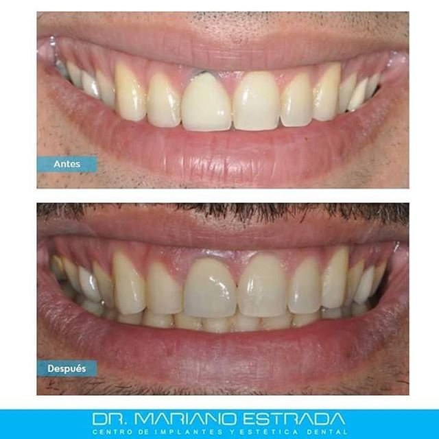 Dr Mariano Estrada CENTRO IMPLANTES Y ESTETICA - Dr Mariano Estrada CENTRO IMPLANTES Y ESTETICA