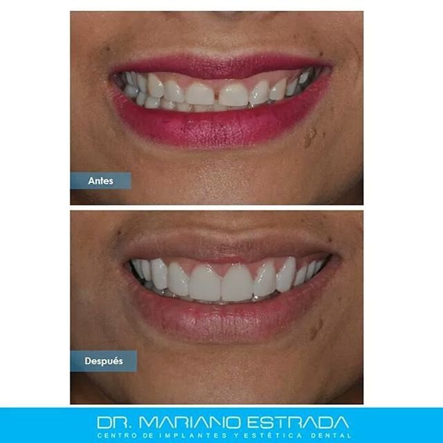 Dr Mariano Estrada CENTRO IMPLANTES Y ESTETICA - Dr Mariano Estrada CENTRO IMPLANTES Y ESTETICA