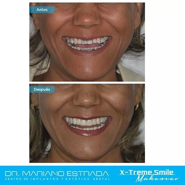 Dr Mariano Estrada CENTRO IMPLANTES Y ESTETICA - Dr Mariano Estrada CENTRO IMPLANTES Y ESTETICA