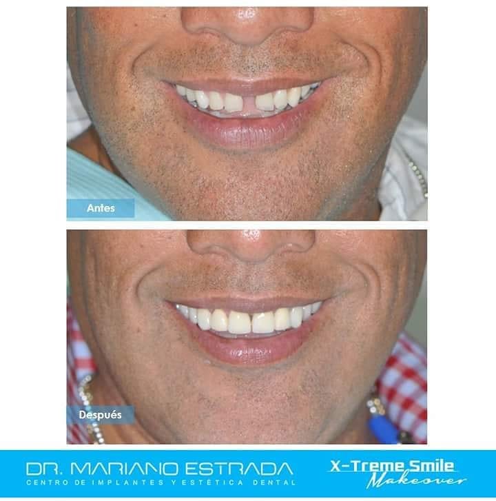 Dr Mariano Estrada CENTRO IMPLANTES Y ESTETICA - Dr Mariano Estrada CENTRO IMPLANTES Y ESTETICA