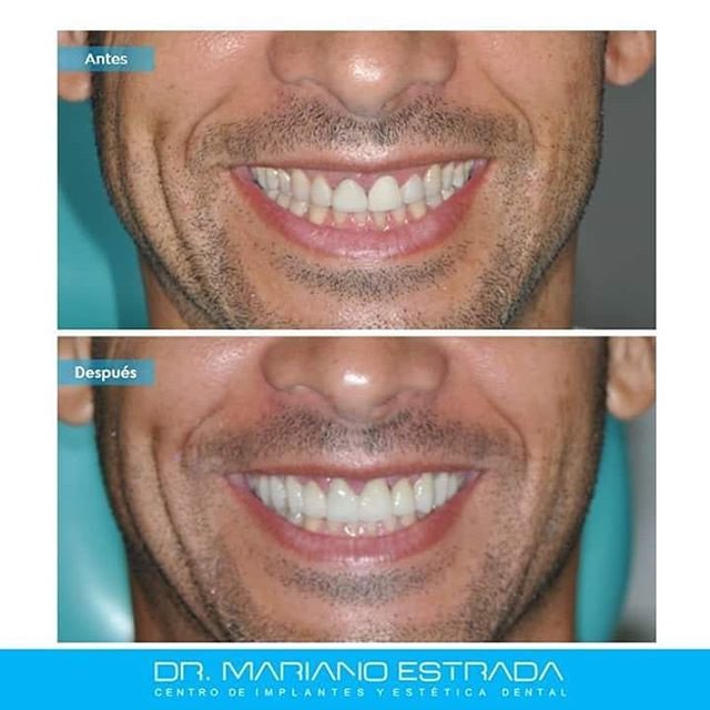 Dr Mariano Estrada CENTRO IMPLANTES Y ESTETICA - Dr Mariano Estrada CENTRO IMPLANTES Y ESTETICA