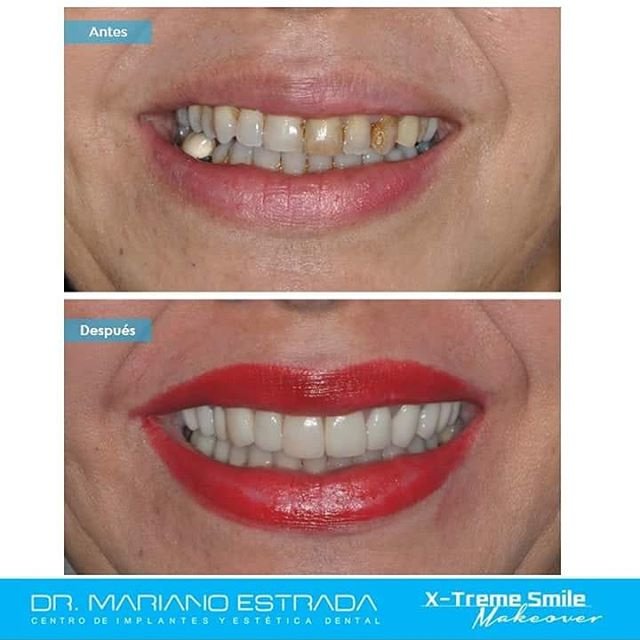 Dr Mariano Estrada CENTRO IMPLANTES Y ESTETICA - Dr Mariano Estrada CENTRO IMPLANTES Y ESTETICA