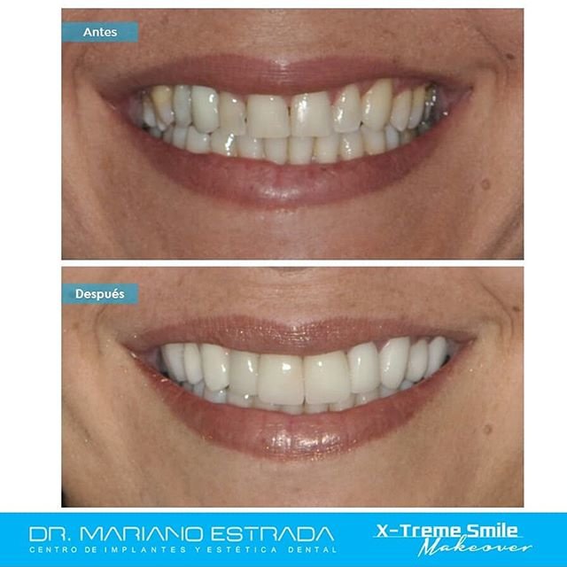 Dr Mariano Estrada CENTRO IMPLANTES Y ESTETICA - Dr Mariano Estrada CENTRO IMPLANTES Y ESTETICA