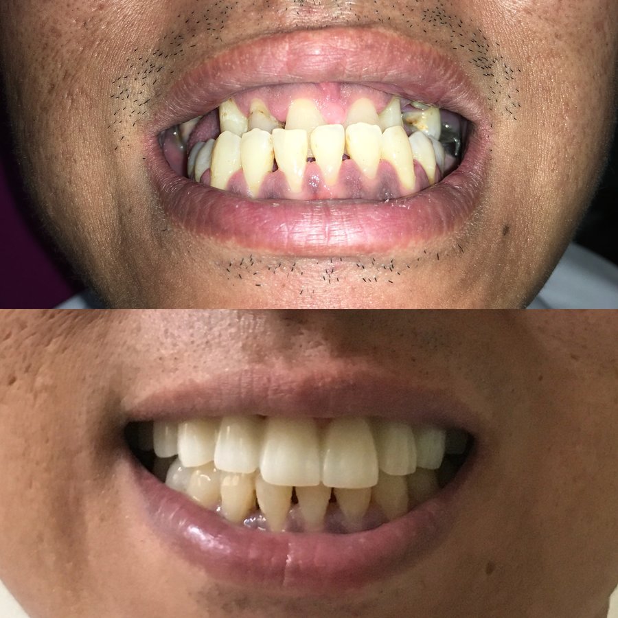 Dr. Marilen G. Roy-Comandao - Dr. Marilen G. Roy-Comandao