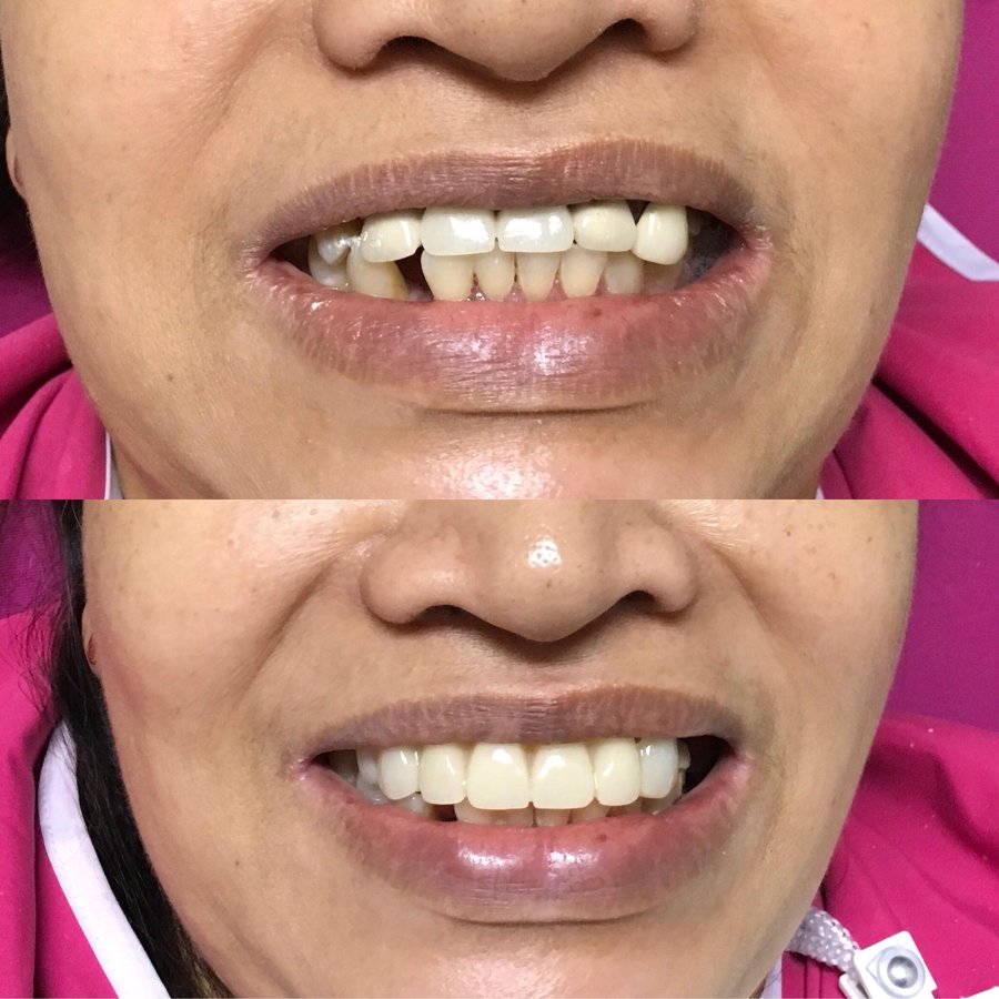 Dr. Marilen G. Roy-Comandao - Dr. Marilen G. Roy-Comandao