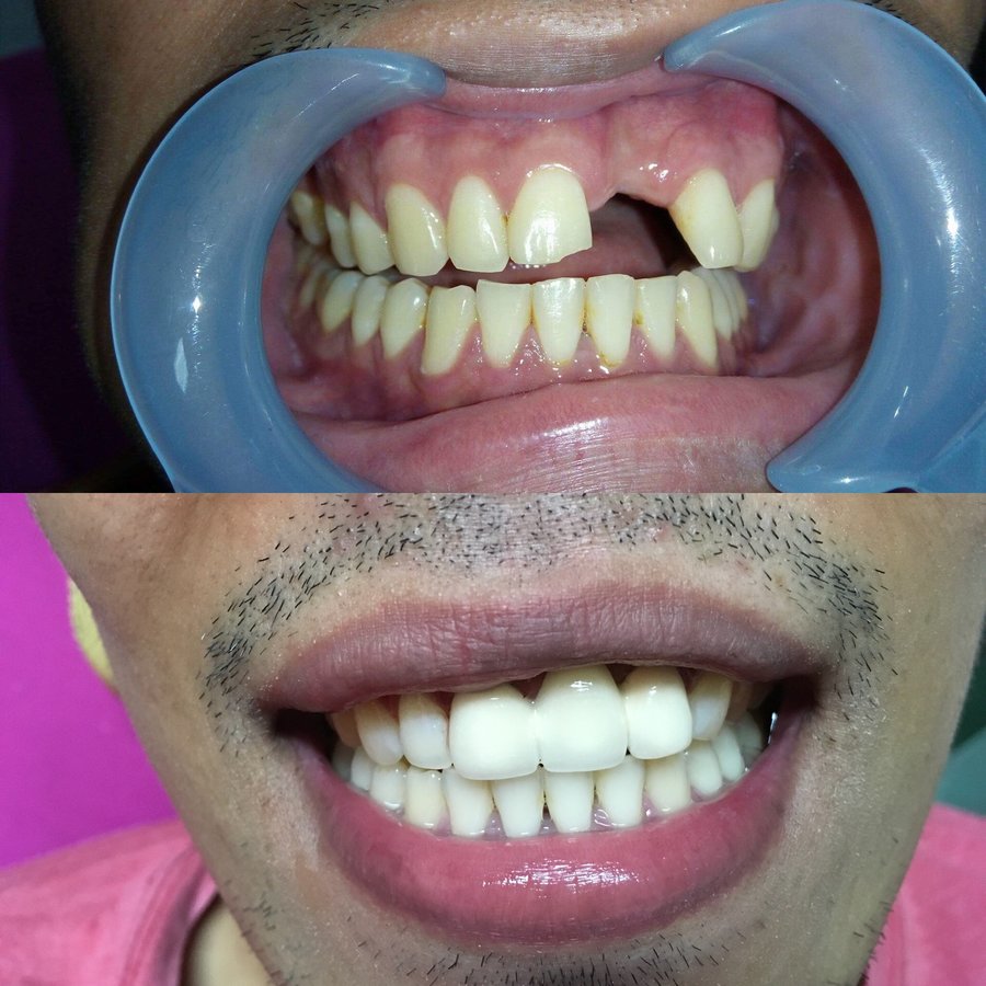 Dr. Marilen G. Roy-Comandao - Dr. Marilen G. Roy-Comandao