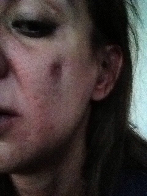 Dr Mark Kohout, Plastic Surgery - Orange - Dr Mark Kohout, Plastic Surgery - Orange