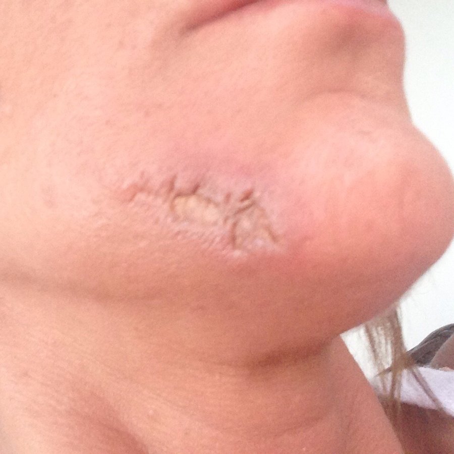 Dr Mark Kohout, Plastic Surgery - Orange - Dr Mark Kohout, Plastic Surgery - Orange