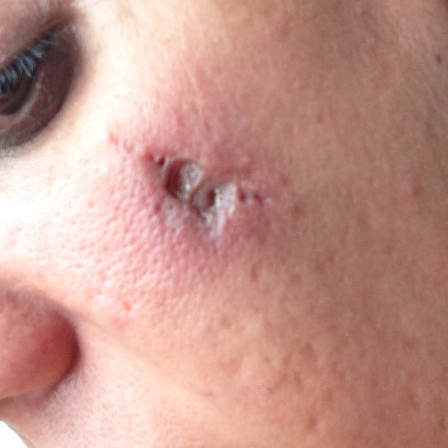 Dr Mark Kohout, Plastic Surgery - Orange - Dr Mark Kohout, Plastic Surgery - Orange