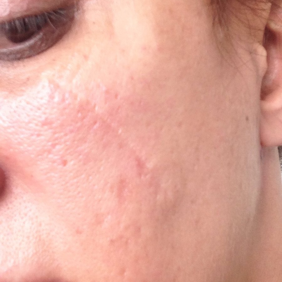 Dr Mark Kohout, Plastic Surgery - Orange - Dr Mark Kohout, Plastic Surgery - Orange