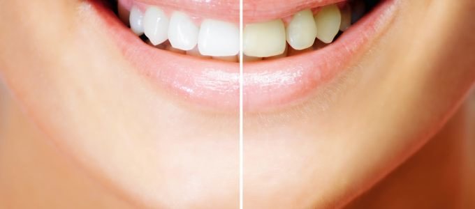 Dr. Med Dent Degenkolb - Dr. Med Dent Degenkolb