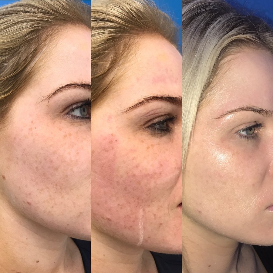 Dr. Michael Zacharia - Dr. Michael Zacharia