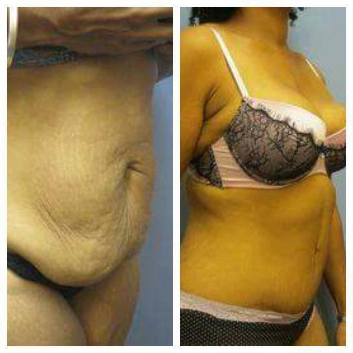 Dr Mohamed Yehia Khalil, Consultant of plastic surgery- Hurghada - Dr Mohamed Yehia Khalil, Consultant of plastic surgery- Hurghada