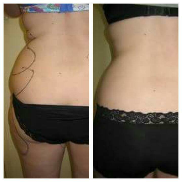 Dr Mohamed Yehia Khalil, Consultant of plastic surgery- Hurghada - Dr Mohamed Yehia Khalil, Consultant of plastic surgery- Hurghada