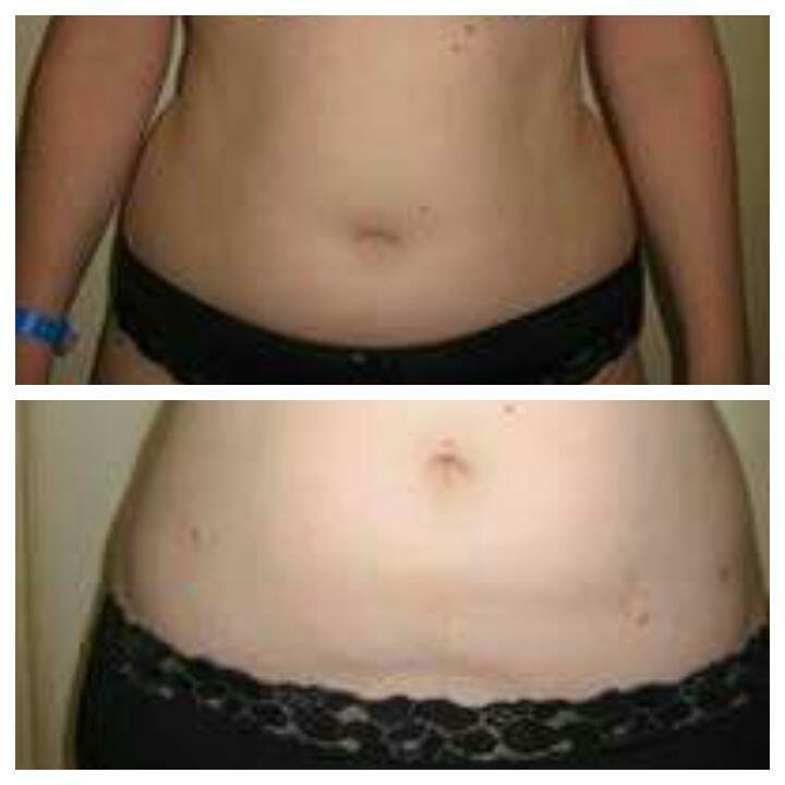 Dr Mohamed Yehia Khalil, Consultant of plastic surgery- Hurghada - Dr Mohamed Yehia Khalil, Consultant of plastic surgery- Hurghada