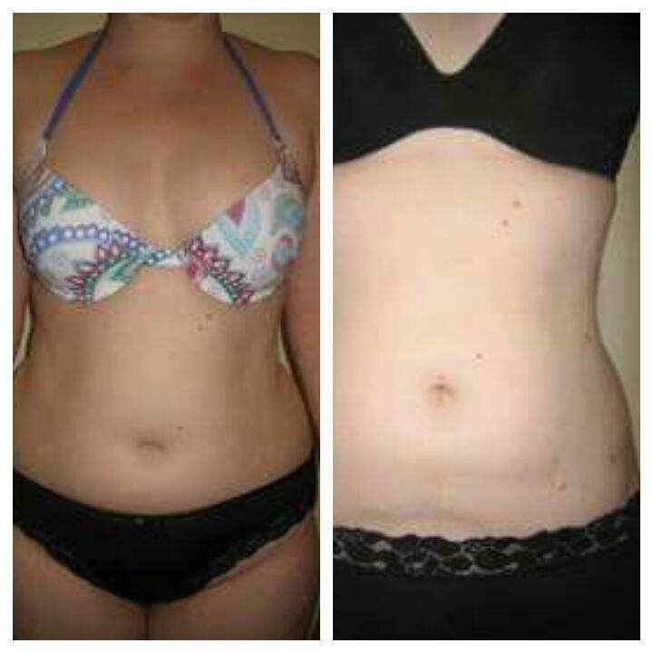 Dr Mohamed Yehia Khalil, Consultant of plastic surgery- Hurghada - Dr Mohamed Yehia Khalil, Consultant of plastic surgery- Hurghada