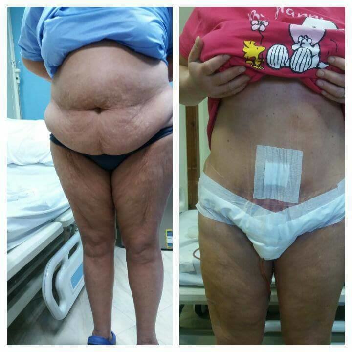 Dr Mohamed Yehia Khalil, Consultant of plastic surgery- Hurghada - Dr Mohamed Yehia Khalil, Consultant of plastic surgery- Hurghada