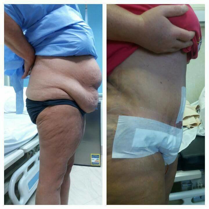 Dr Mohamed Yehia Khalil, Consultant of plastic surgery- Hurghada - Dr Mohamed Yehia Khalil, Consultant of plastic surgery- Hurghada