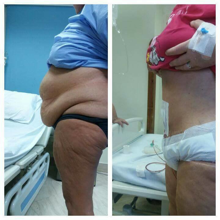 Dr Mohamed Yehia Khalil, Consultant of plastic surgery- Hurghada - Dr Mohamed Yehia Khalil, Consultant of plastic surgery- Hurghada