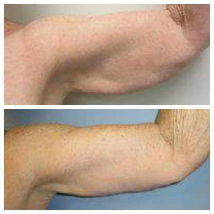 Dr Mohamed Yehia Khalil, Consultant of plastic surgery- Hurghada - Dr Mohamed Yehia Khalil, Consultant of plastic surgery- Hurghada