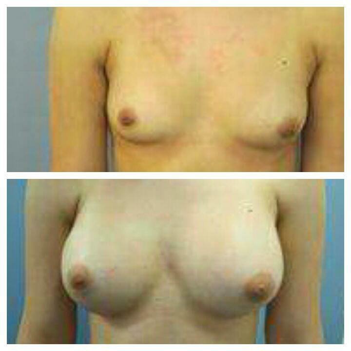 Dr Mohamed Yehia Khalil, Consultant of plastic surgery- Hurghada - Dr Mohamed Yehia Khalil, Consultant of plastic surgery- Hurghada