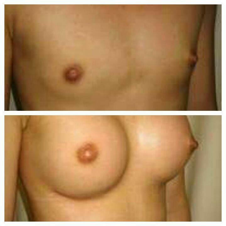 Dr Mohamed Yehia Khalil, Consultant of plastic surgery- Hurghada - Dr Mohamed Yehia Khalil, Consultant of plastic surgery- Hurghada