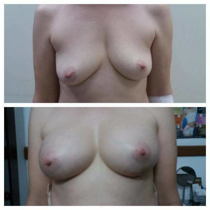 Dr Mohamed Yehia Khalil, Consultant of plastic surgery- Hurghada - Dr Mohamed Yehia Khalil, Consultant of plastic surgery- Hurghada