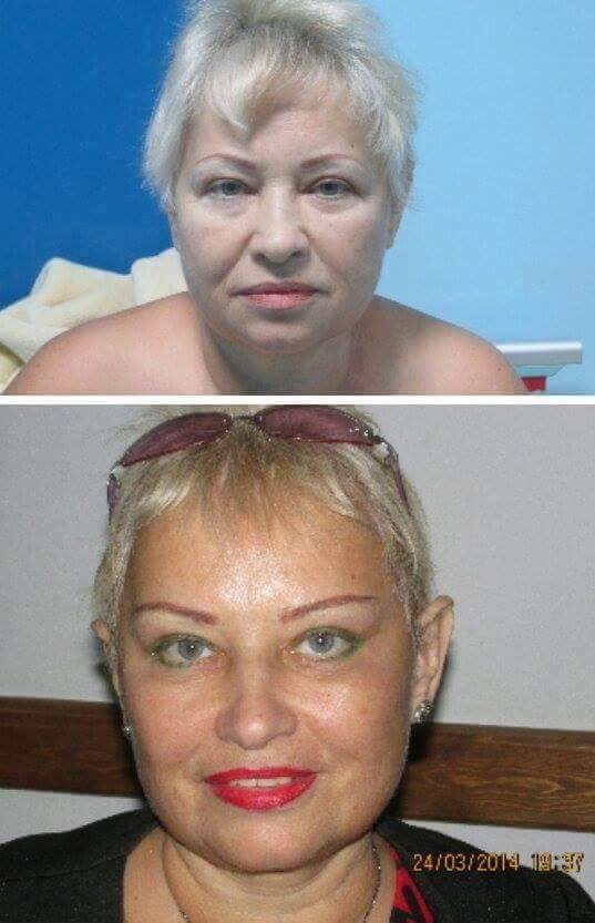 Dr Mohamed Yehia Khalil, Consultant of plastic surgery- Hurghada - Dr Mohamed Yehia Khalil, Consultant of plastic surgery- Hurghada