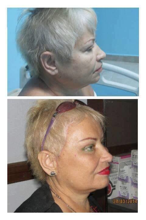 Dr Mohamed Yehia Khalil, Consultant of plastic surgery- Hurghada - Dr Mohamed Yehia Khalil, Consultant of plastic surgery- Hurghada