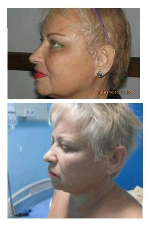 Dr Mohamed Yehia Khalil, Consultant of plastic surgery- Hurghada - Dr Mohamed Yehia Khalil, Consultant of plastic surgery- Hurghada