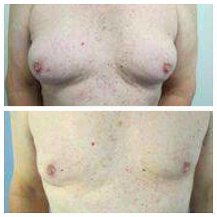 Dr Mohamed Yehia Khalil, Consultant of plastic surgery- Hurghada - Dr Mohamed Yehia Khalil, Consultant of plastic surgery- Hurghada