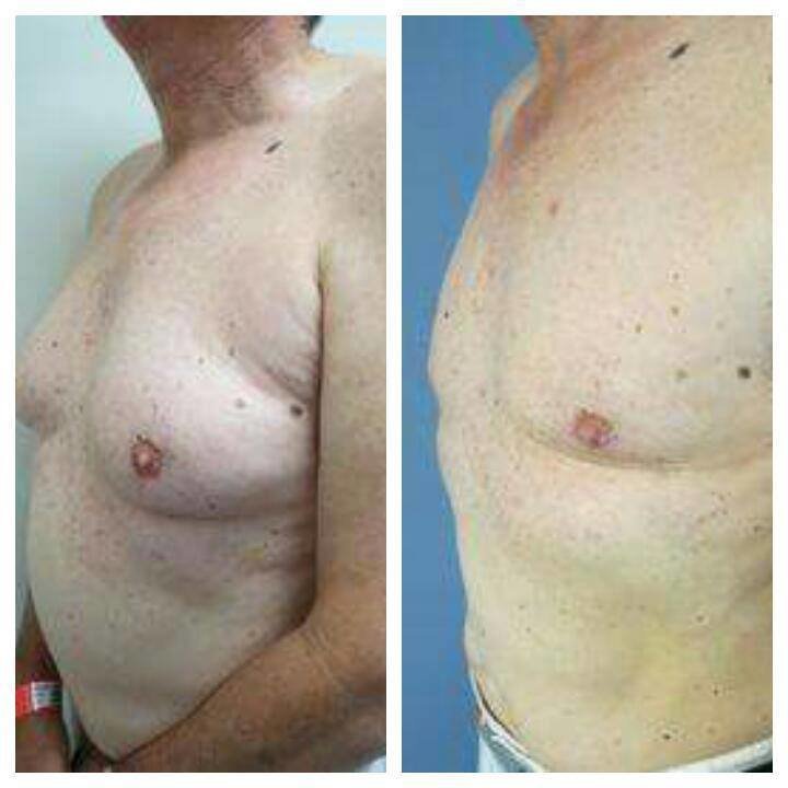 Dr Mohamed Yehia Khalil, Consultant of plastic surgery- Hurghada - Dr Mohamed Yehia Khalil, Consultant of plastic surgery- Hurghada