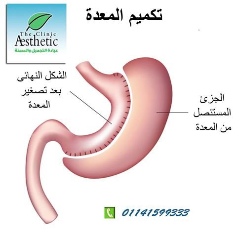 Dr Mohamed Yehia Khalil, Consultant of plastic surgery- Hurghada - Dr Mohamed Yehia Khalil, Consultant of plastic surgery- Hurghada