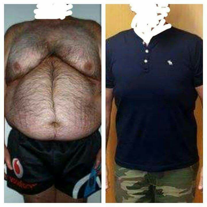 Dr Mohamed Yehia Khalil, Consultant of plastic surgery- Hurghada - Dr Mohamed Yehia Khalil, Consultant of plastic surgery- Hurghada