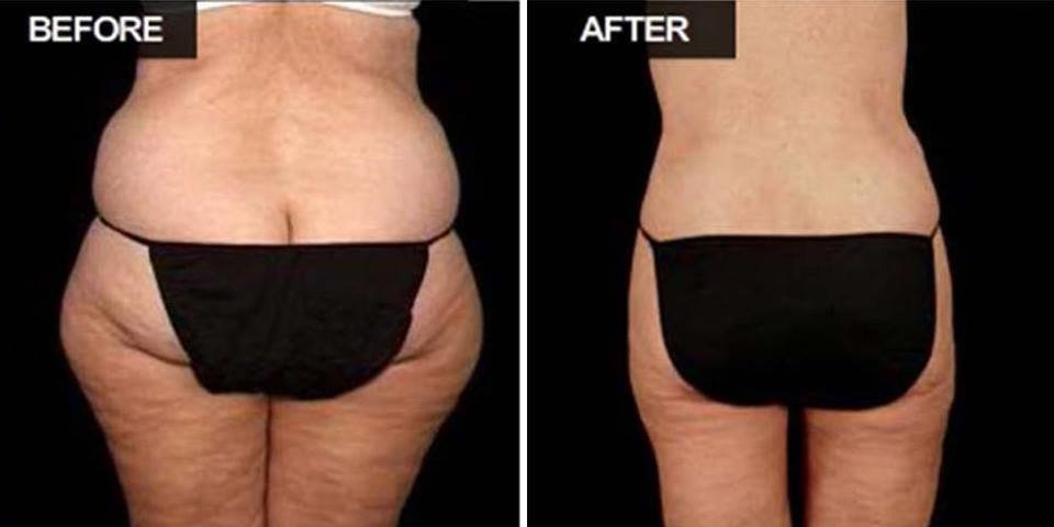 Dr Mohamed Yehia Khalil, Consultant of plastic surgery- Hurghada - Dr Mohamed Yehia Khalil, Consultant of plastic surgery- Hurghada